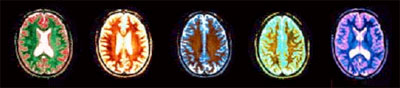 최첨단 뇌영상장비인 fMRI 로 찍은 '뇌' 영상 